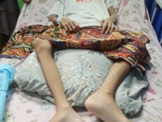 Akbar, Pelajar MTsN Salido, Dirawat Intensif Akibat Tumor Mediastinum di Padang