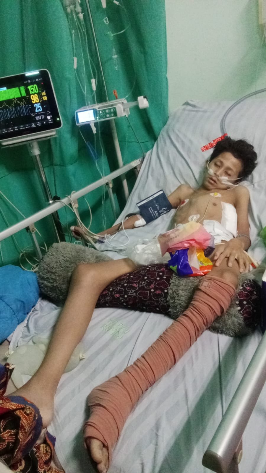 Akbar pelajar MTsN Salido menjalani perawatan di RSUP M. Jamil Padang sebelum meninggal dunia akibat tumor.
